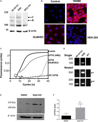 Cystic Fibrosis Transmembrane Conductance Regulator (CFTR) in Human Lung Microvascular Endothelial Cells Controls Oxidative Stress, Reactive Oxygen-Mediated Cell Signaling and Inflammatory Responses